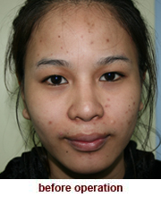 plastic_surgery_augmentation_rhinoplasty